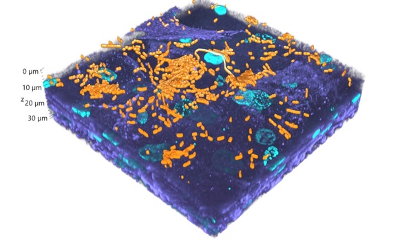 Addressing antimicrobial resistance through advanced UTI models
